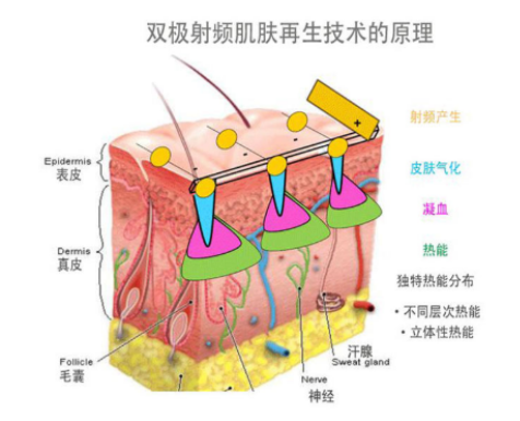 李佳齊推薦的便攜式美容儀,歐姆龍輕觸開(kāi)關(guān)性?xún)r(jià)比王炸!